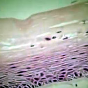 Story Image